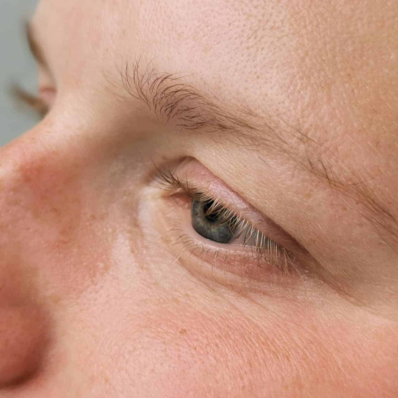 Wimpernlifting vorher