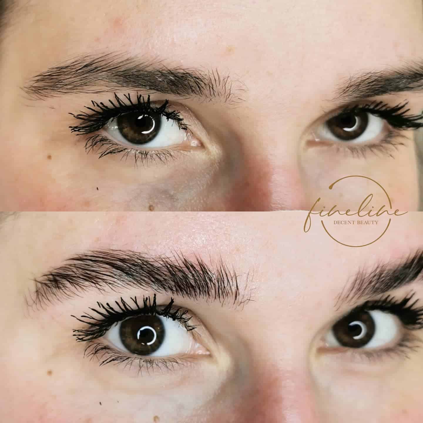 Browlifting Vorher Nachher