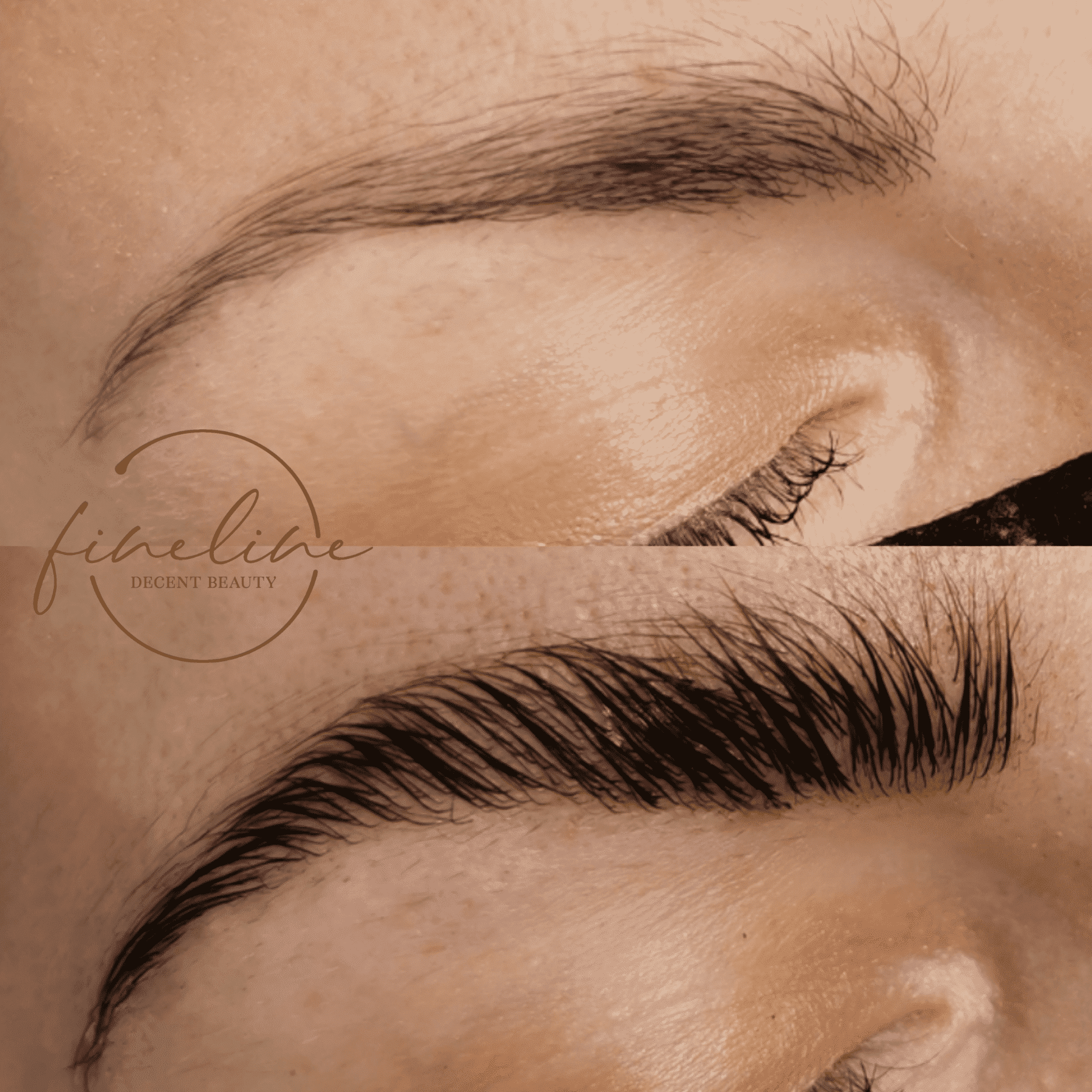 Browlifting Braunschweig Browlifting Braunschweig