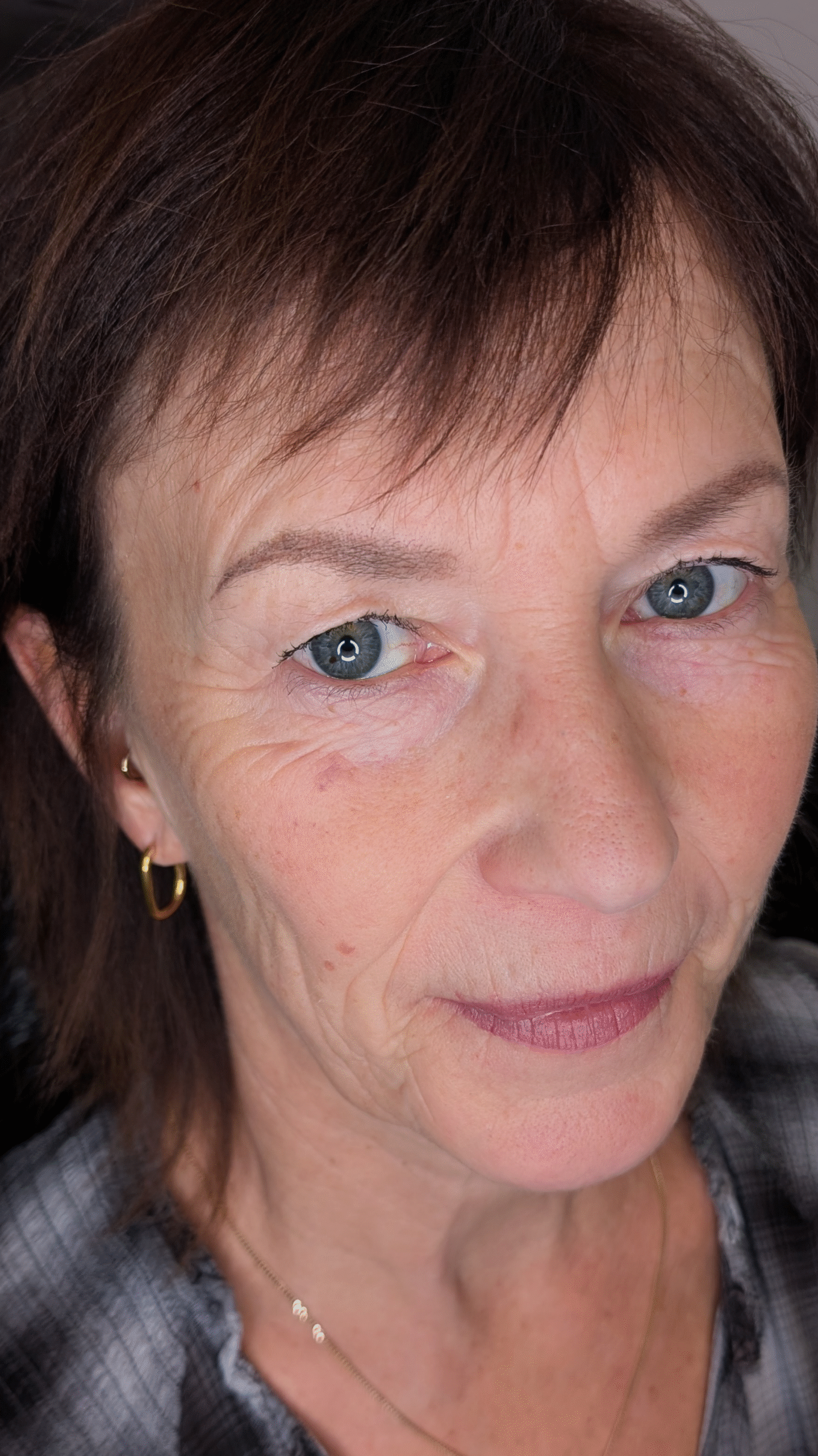 Abgeheilt nach einer Sitzung